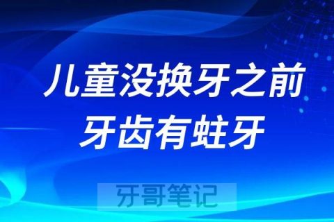 儿童没换牙之前牙齿有蛀牙需要治疗吗