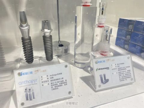 种植牙真实照片图片