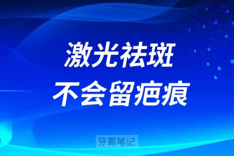 激光祛斑是什么原理为什么不会留疤痕